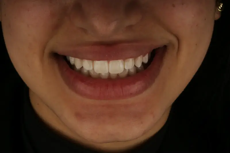 Patiente souriante lors d’une consultation dentaire